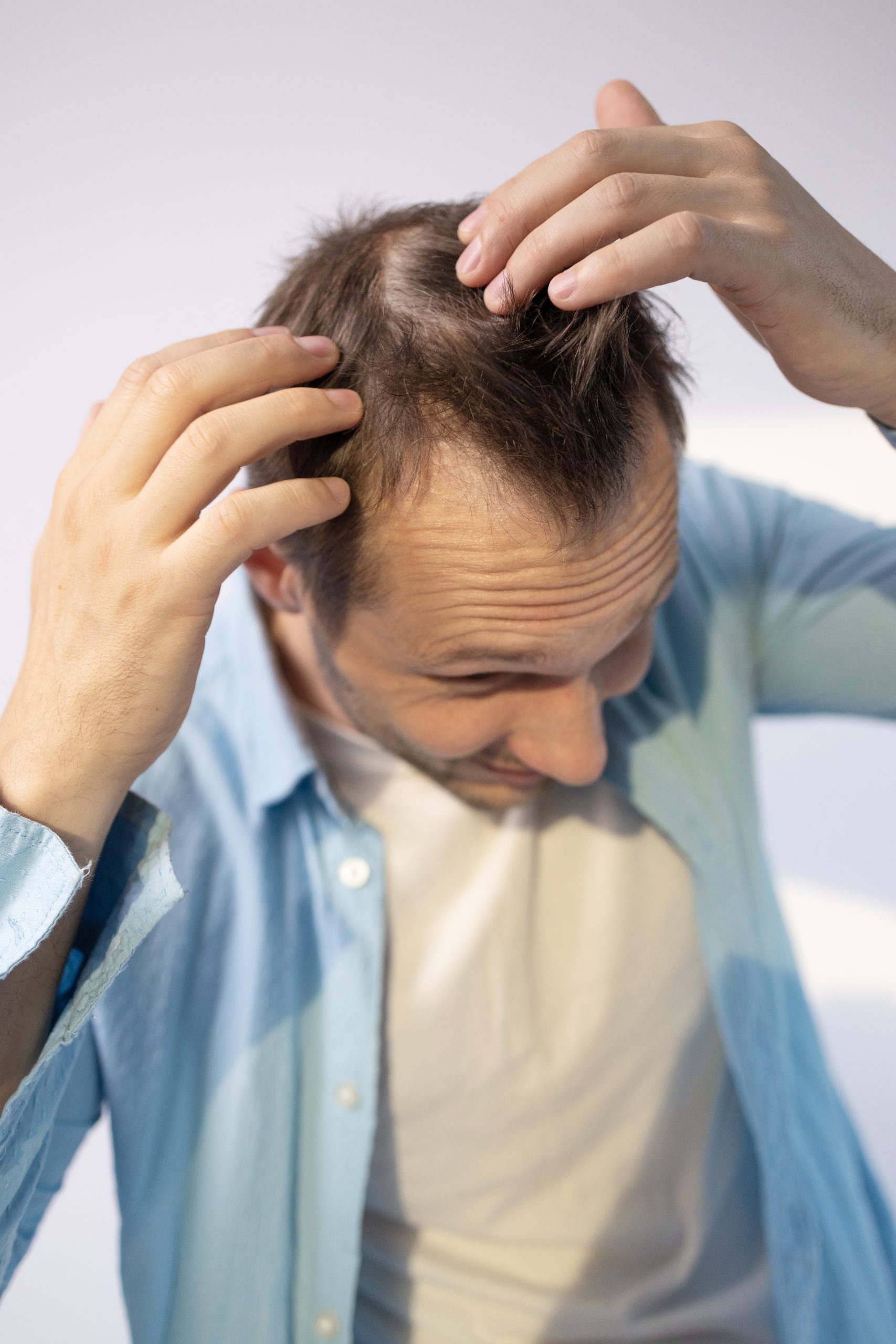 Man examining thinning hair on his scalp with both hands