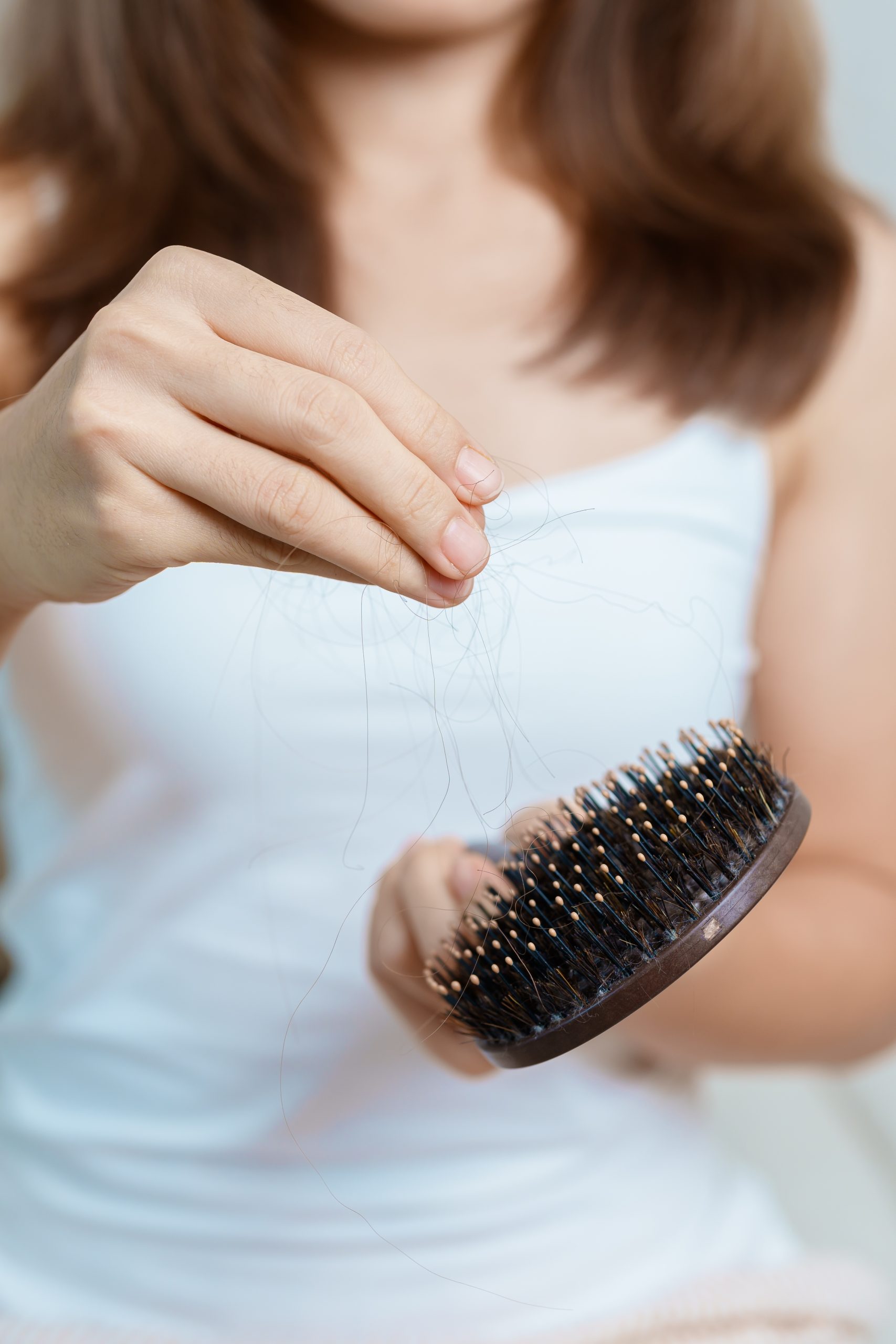 Woman holding a brush showing hair loss with strands caught in the bristles