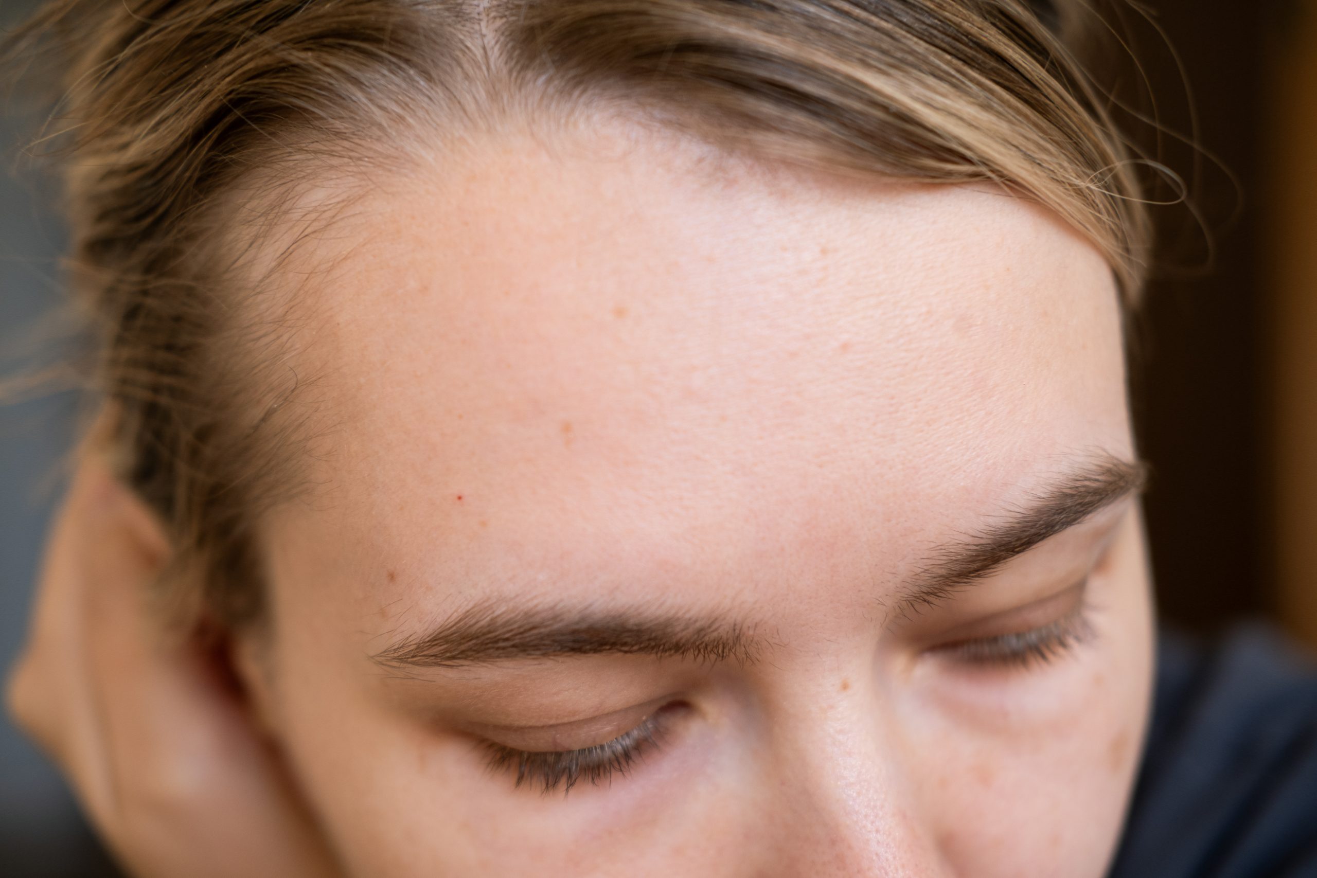 Woman's forehead showing hairline and brow area
