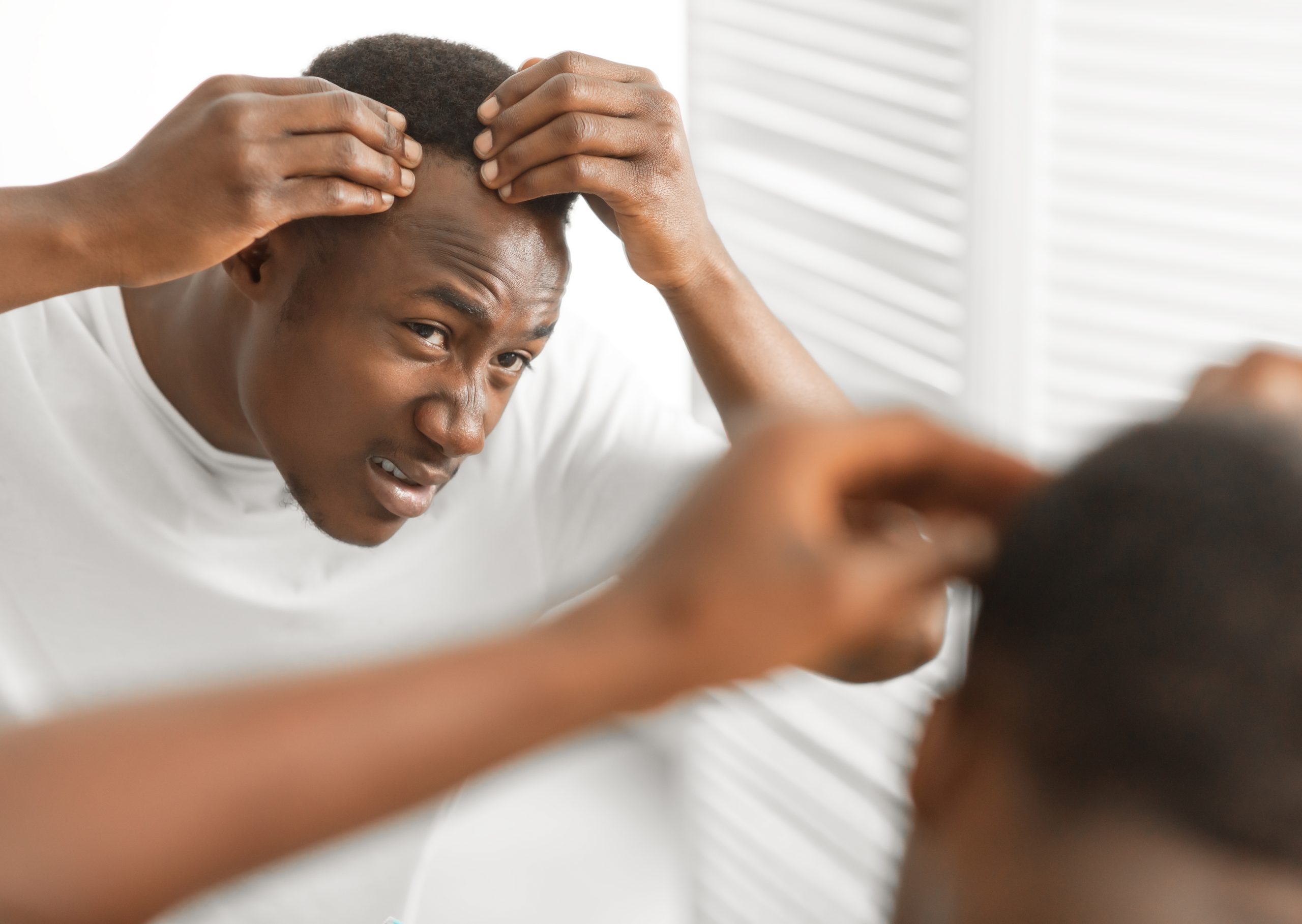 Man examining hair loss on his scalp in mirror