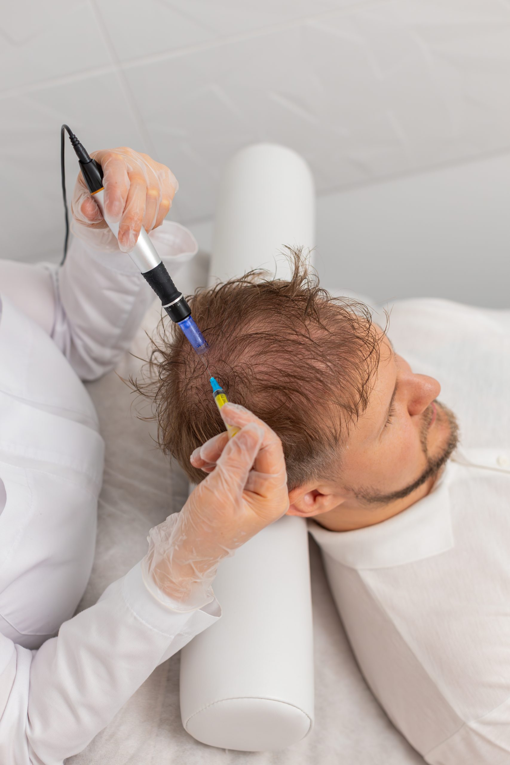 Clinician marking scalp treatment points with colored pen on male patient