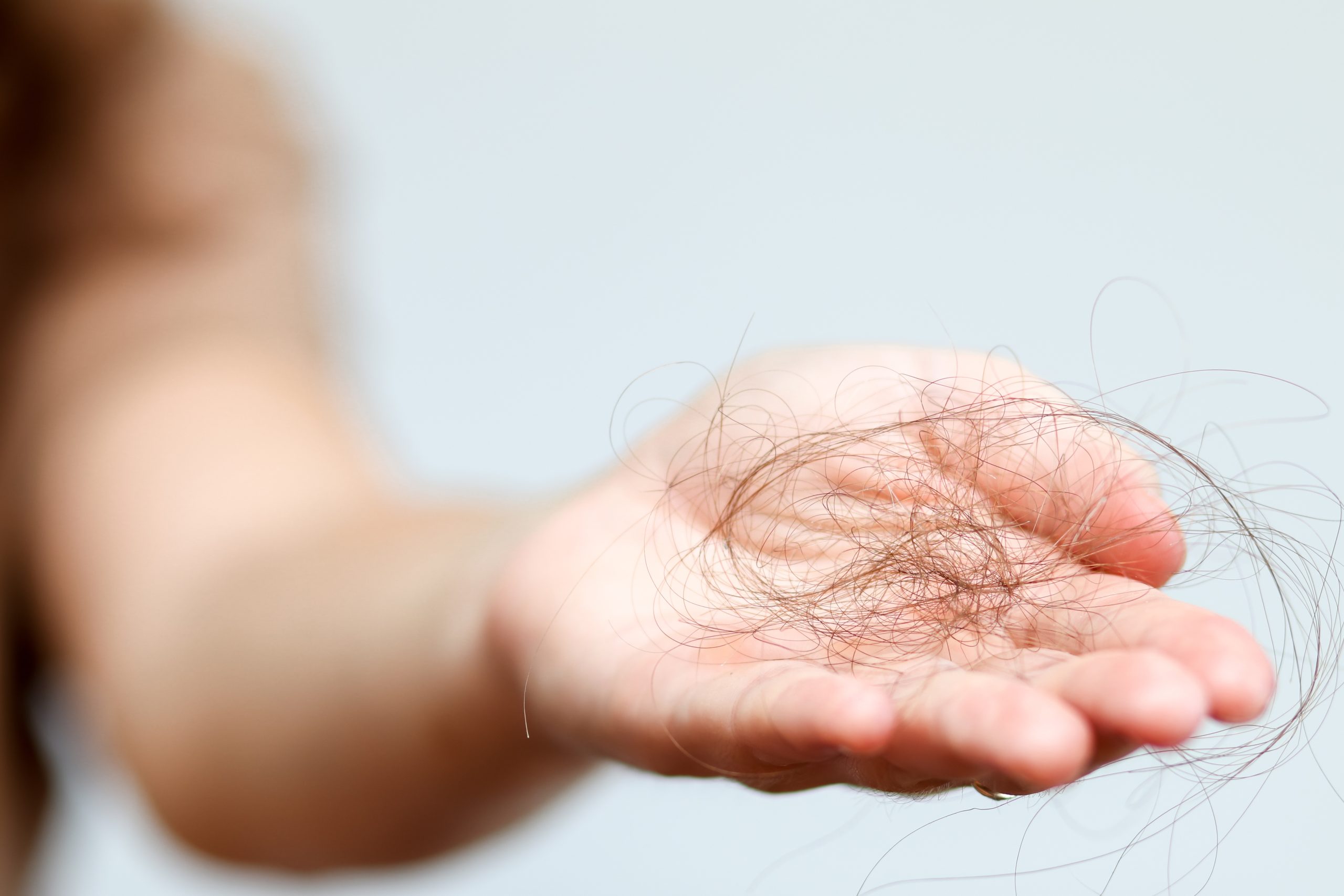 Handful of shed hair held in open palm showing hair loss