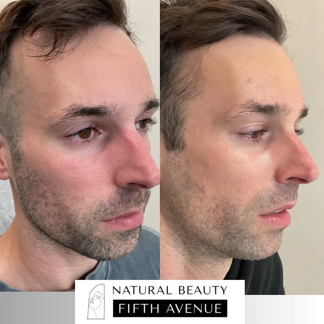 Skincare and Topical Regimens before and after