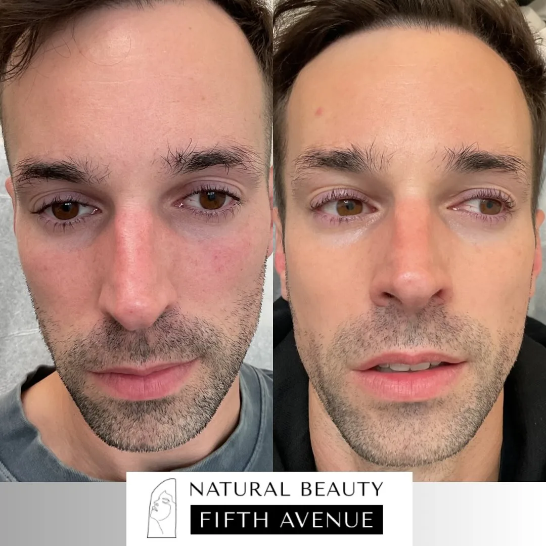 Skincare and Topical Regimens before and after at Natural Beauty NYC (3 of 3)