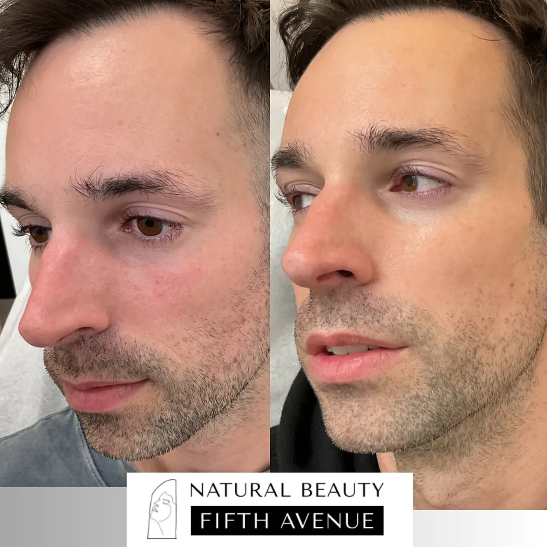 Skincare and Topical Regimens before and after at Natural Beauty NYC (2 of 3)