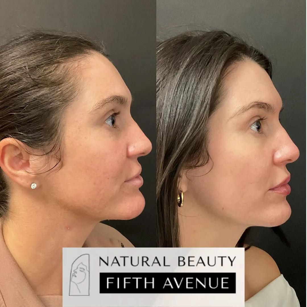 Skincare and Oral Medication before and after
