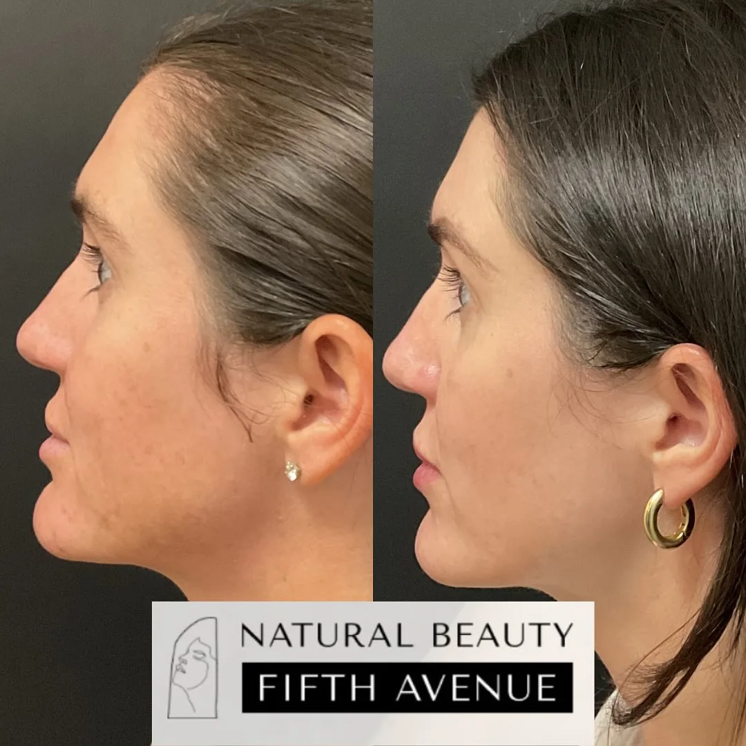 Skincare and Oral Medication before and after at Natural Beauty NYC (2 of 5)