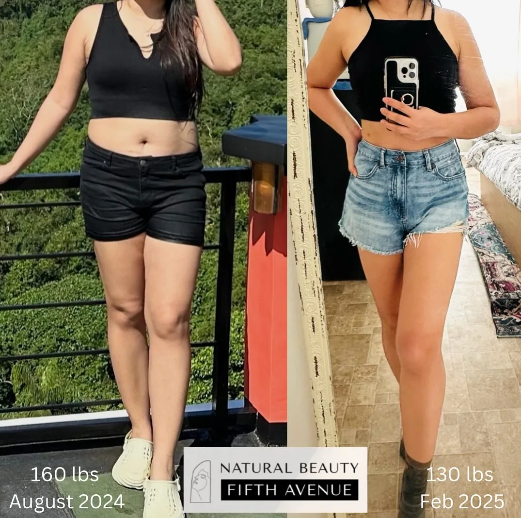 Weight Loss Program before and after