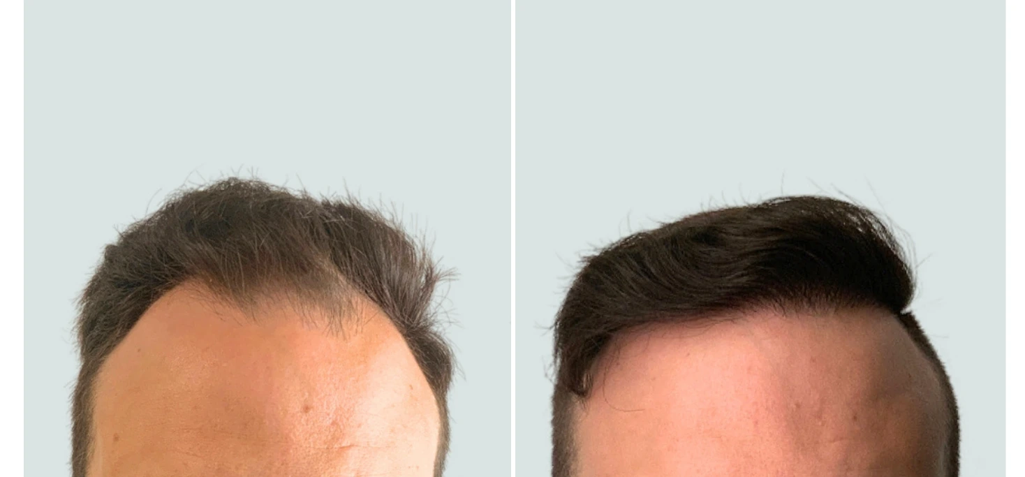 regeneris hair (12)