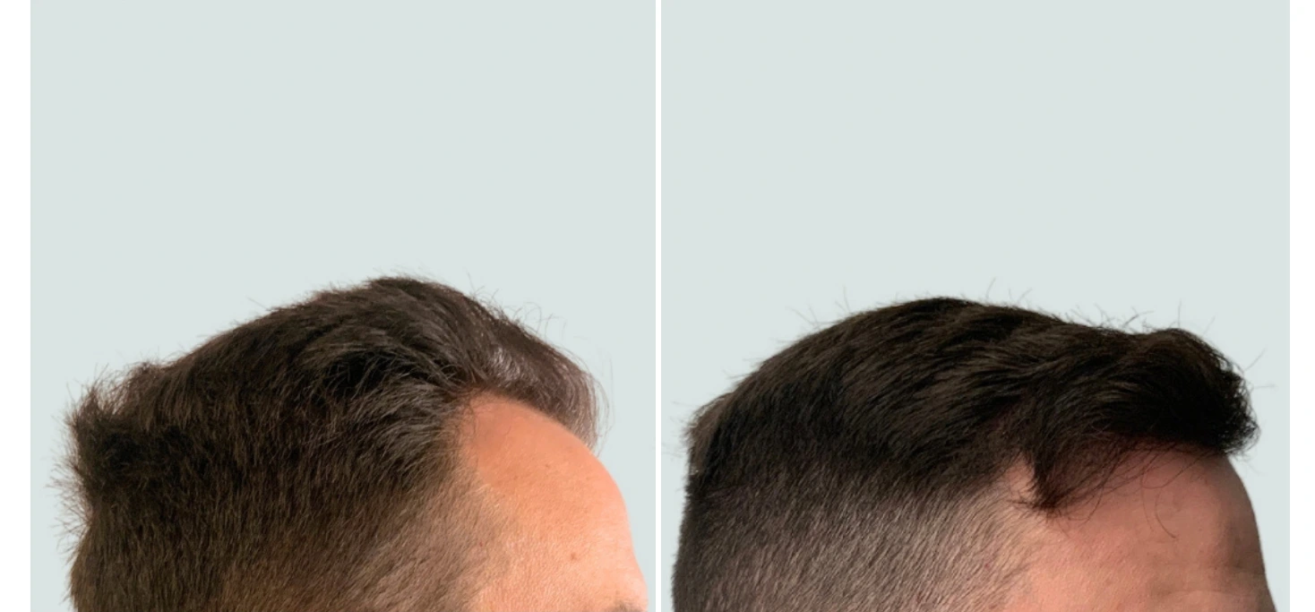 regeneris hair (14)