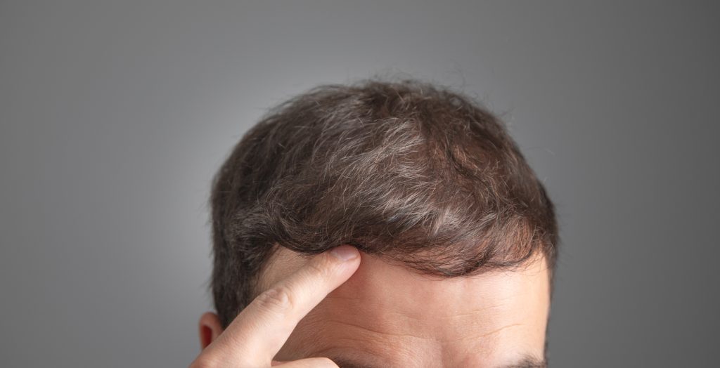 Is Hair Transplant Safe? Risks, Safety Factors, and Medical Considerations Explained Banner