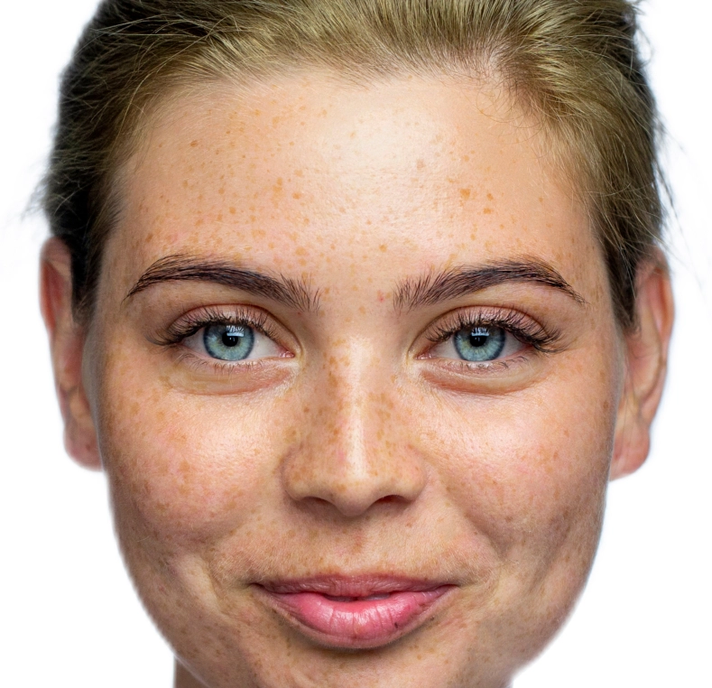 Person with blue eyes and freckles looking directly at camera
