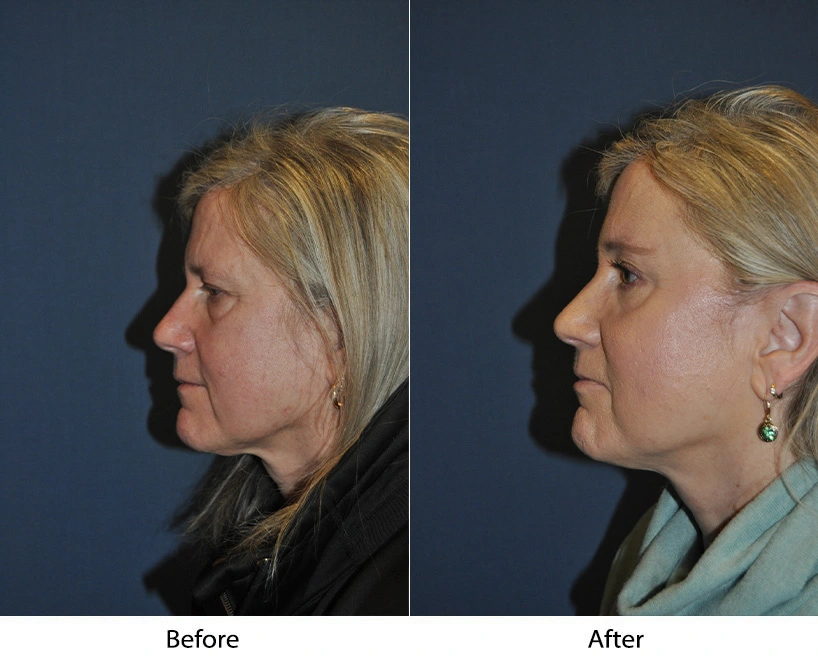 6178-1-1 (1)