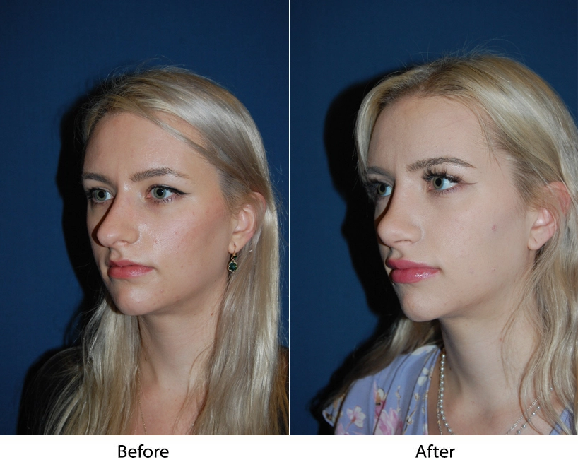 7927-3