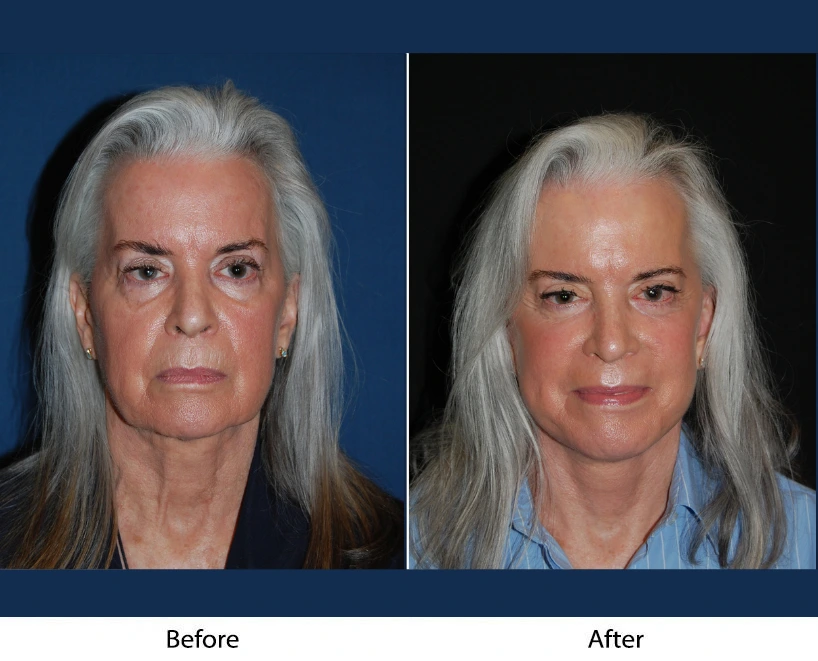 Only Faces Template - 2024-10-11T124118.125