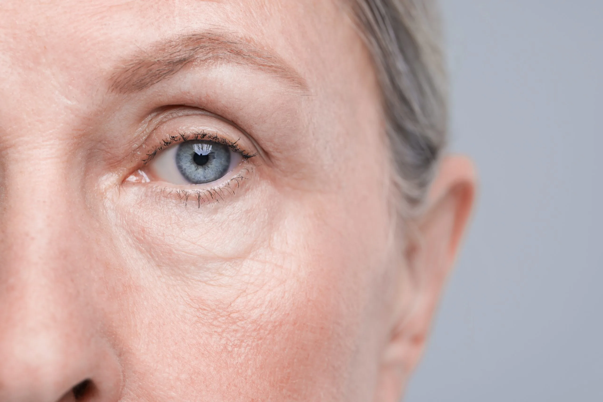 Who Is a Good Candidate for Lower Blepharoplasty? Banner