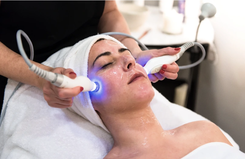 Facial Lasers image