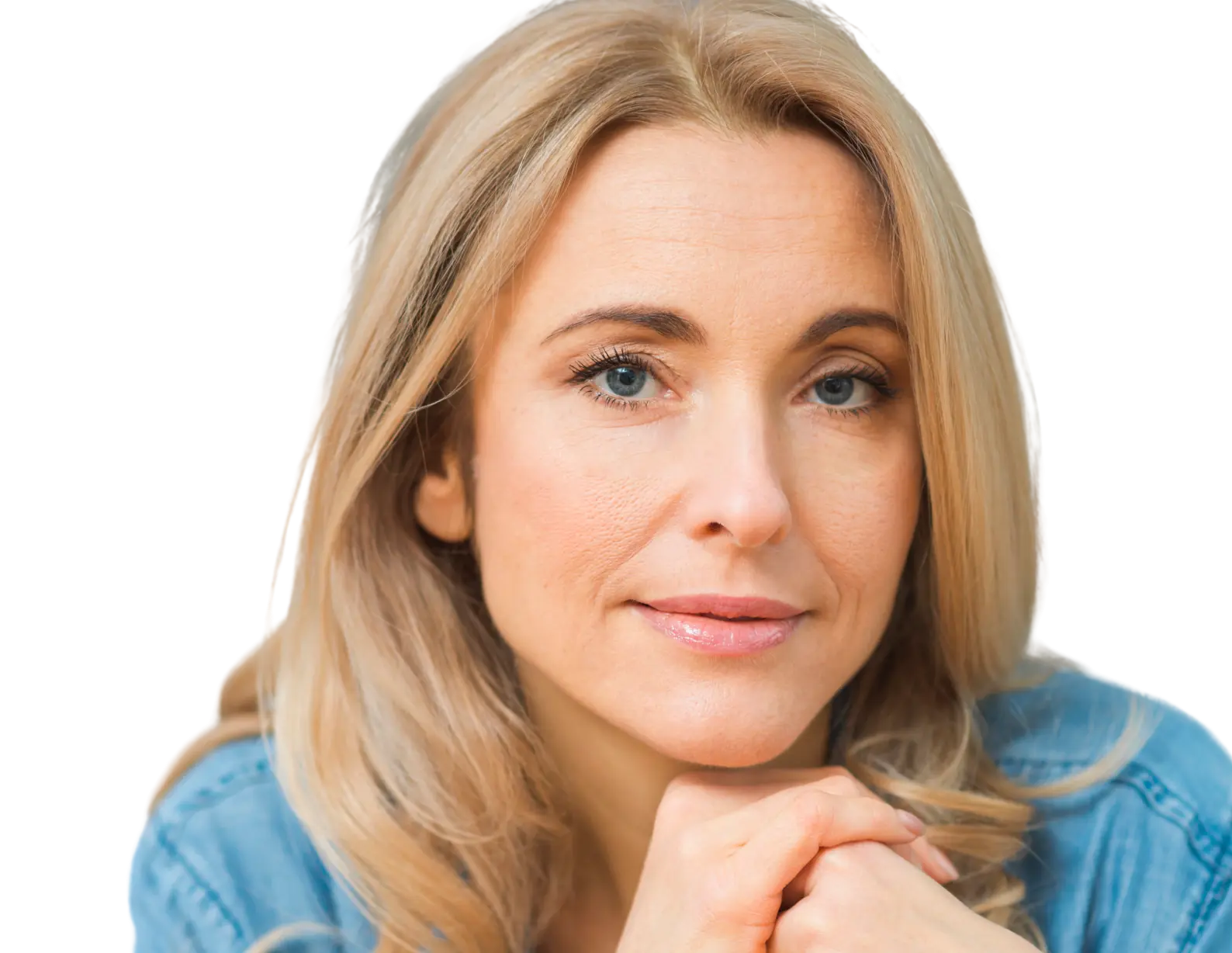 Recovery After VI Chemical Peels Banner