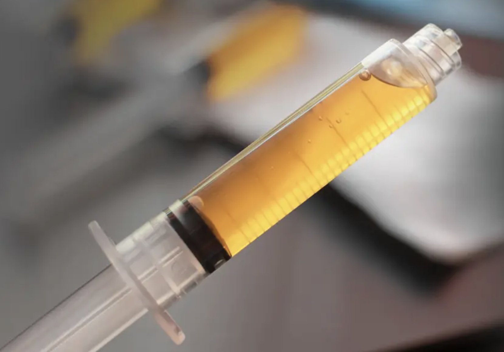 Syringe filled with golden PRF prepared from a patient’s own blood
