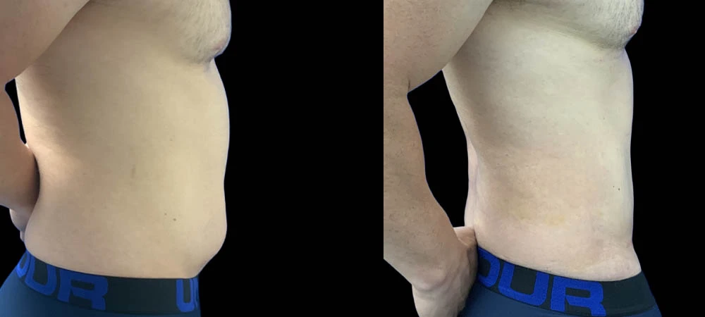 0003_lipo1of07.JPEG