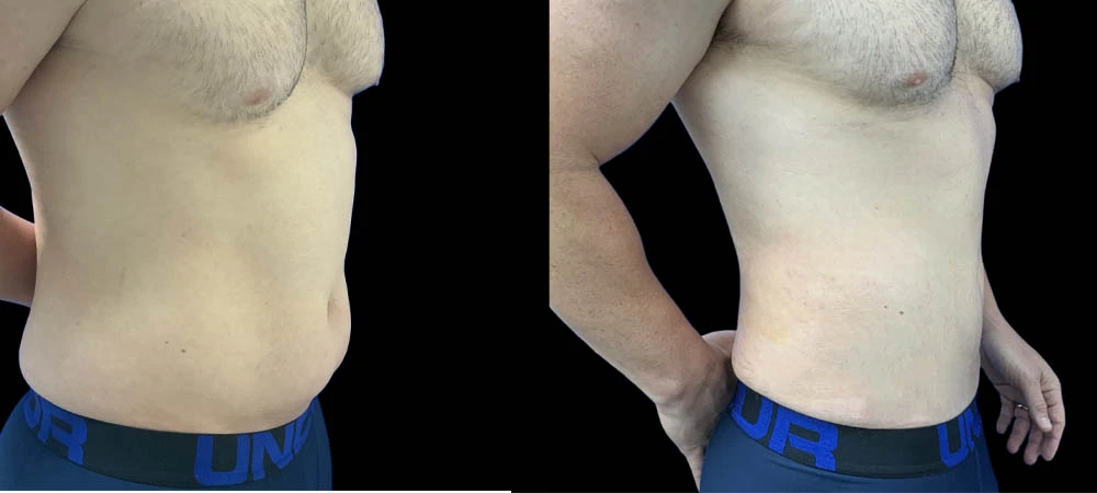 0004_lipo1of09.JPEG