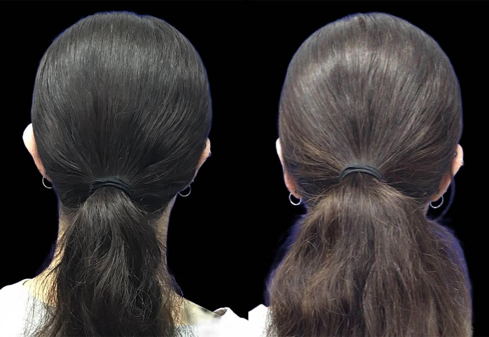 0007_EARS-POSTERIOR-VIEW-BEFORE