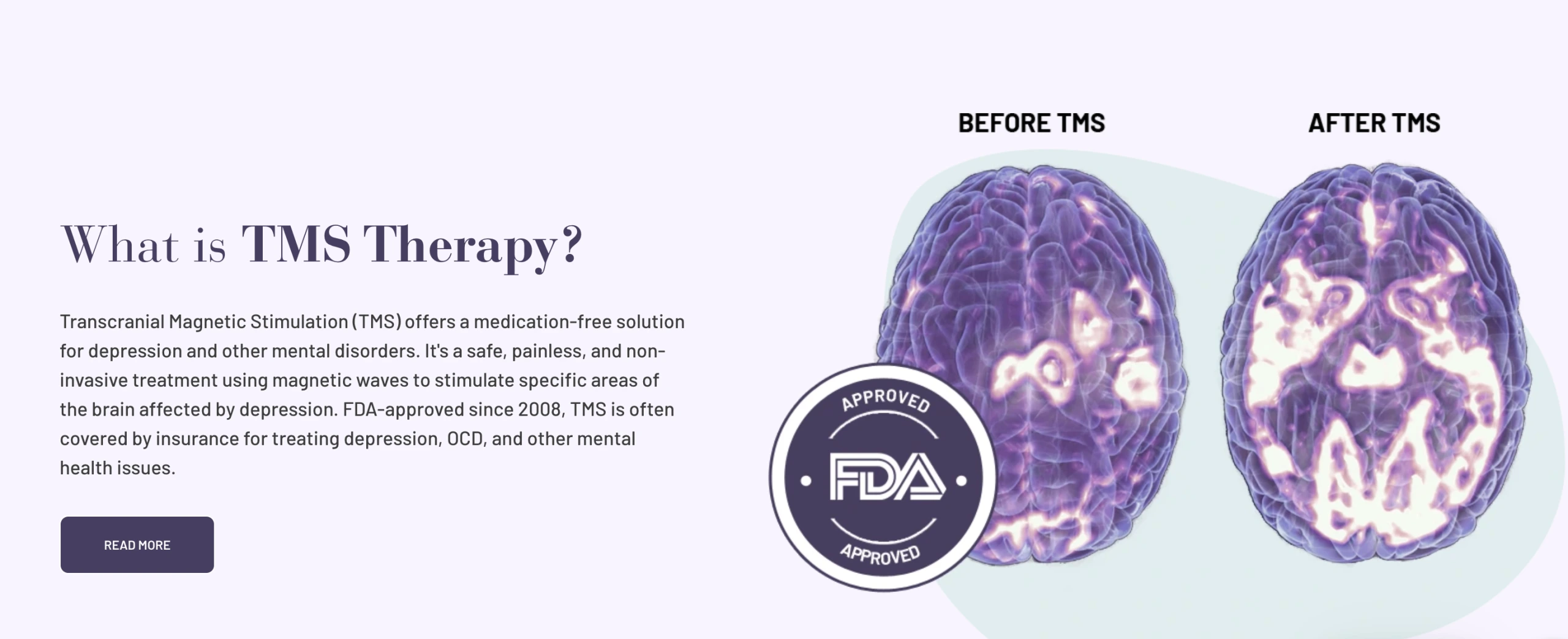TMS website example