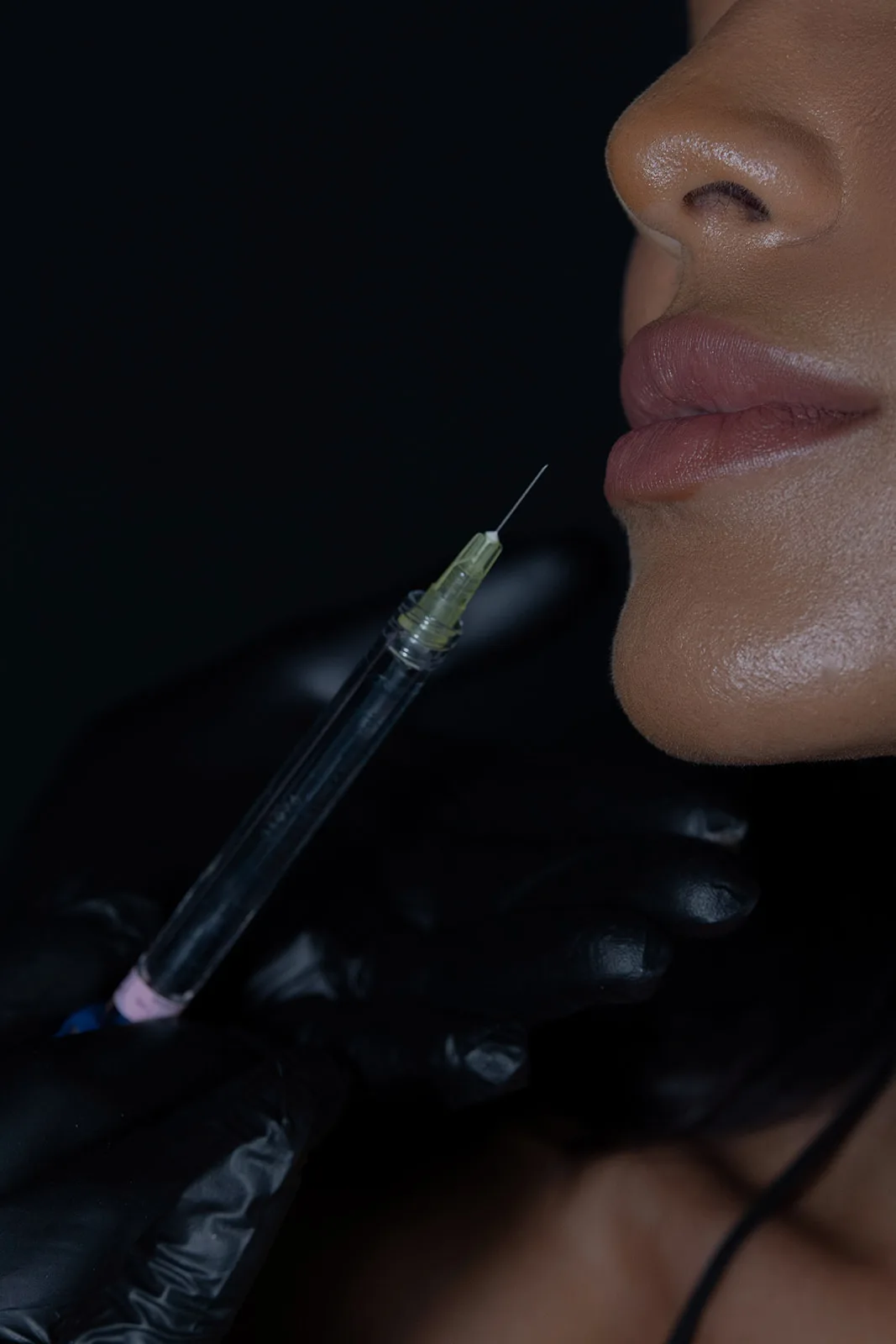 Injectable syringe positioned near woman's lips for filler treatment