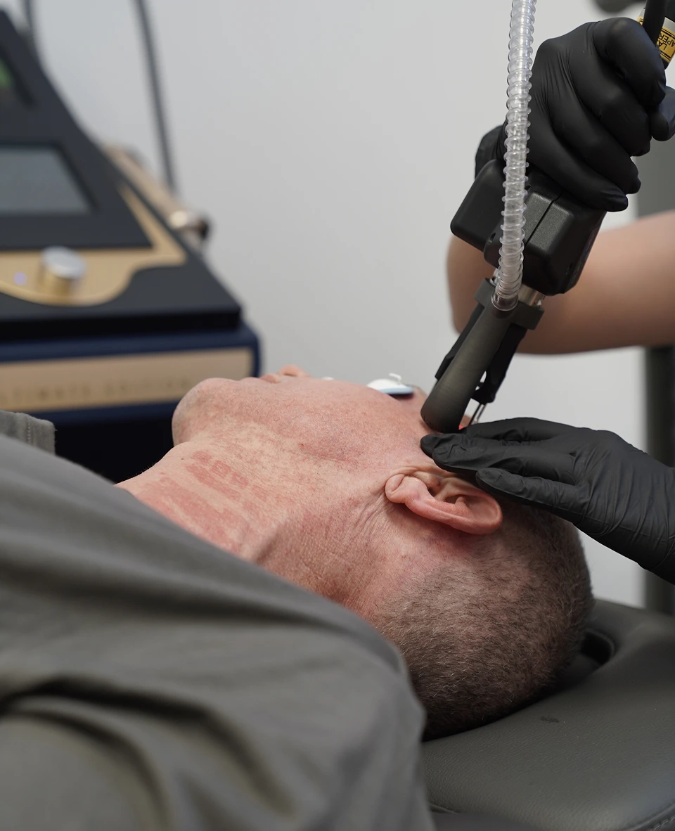 Practitioner using DEKA pulse laser device on patient's face during treatment