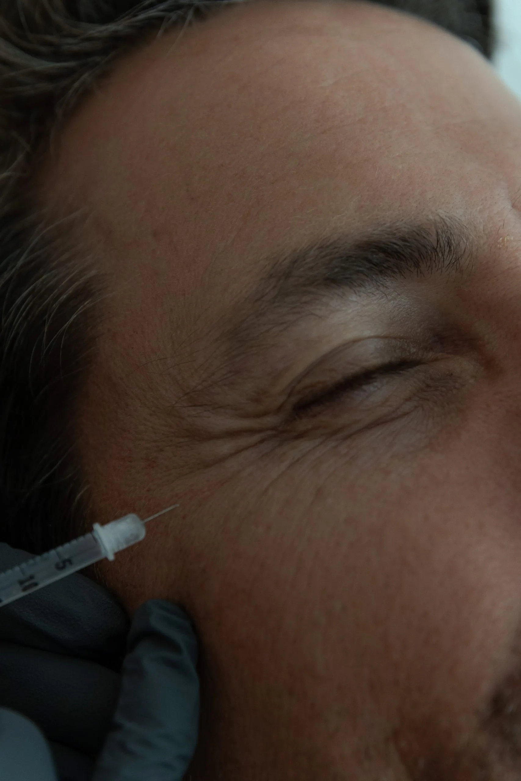 Practitioner administering filler injection to patient's cheek area