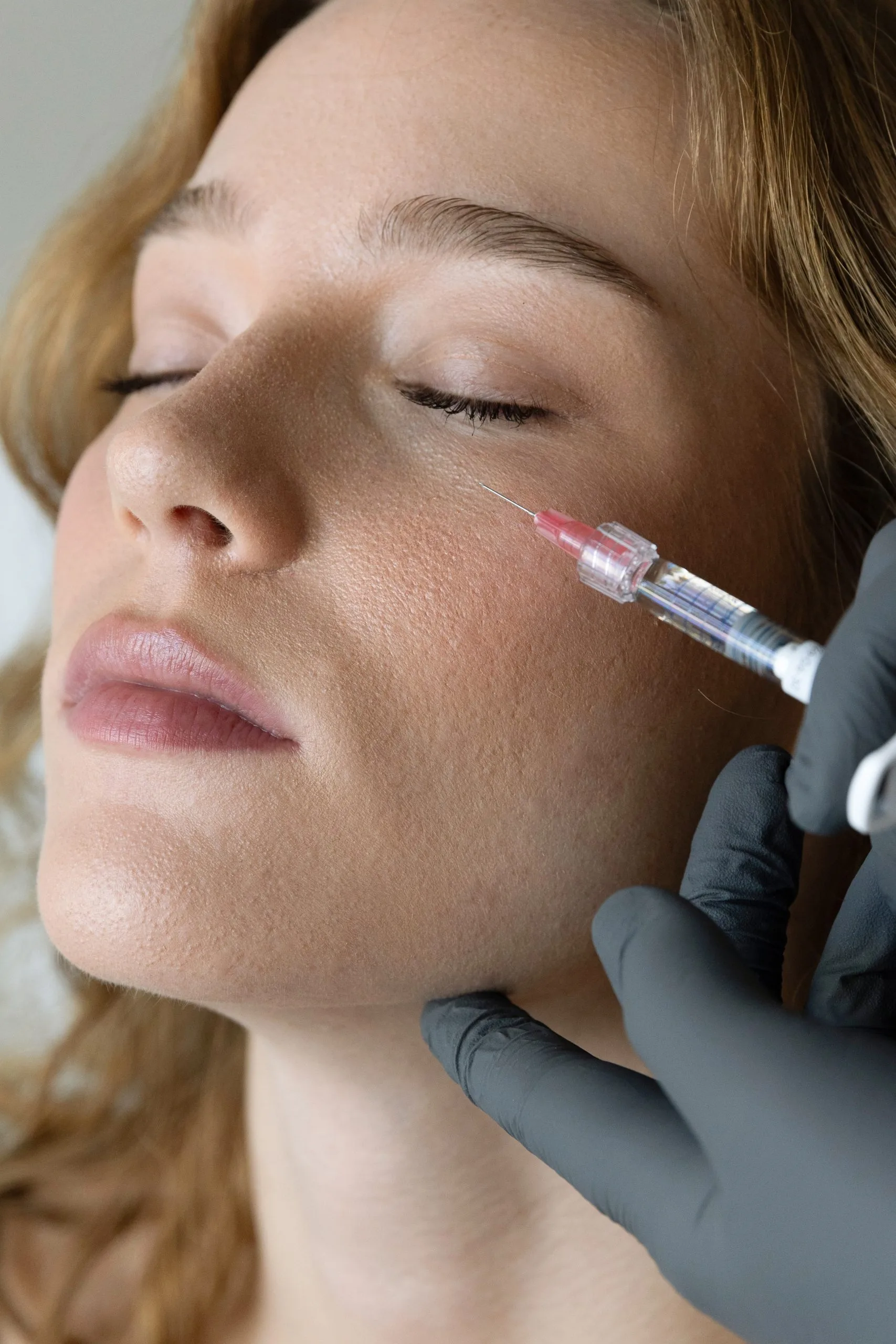 Gloved hand administering filler injection to patient's cheek near temple