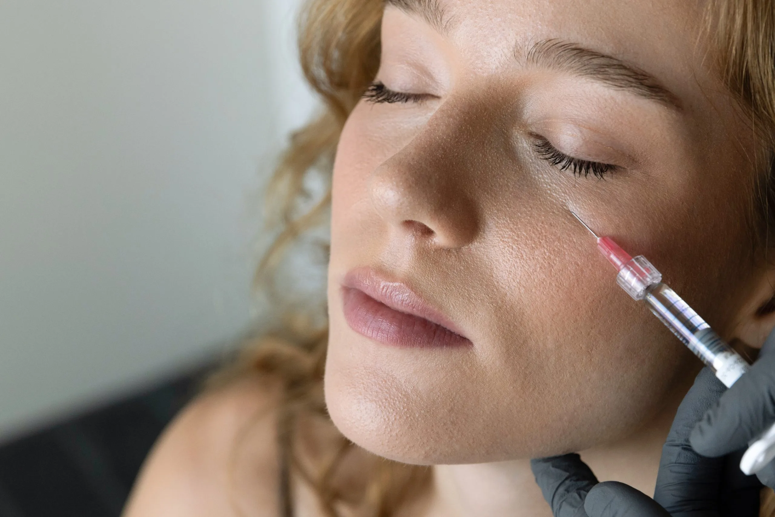 Gloved hand injecting filler into patient's cheekbone area