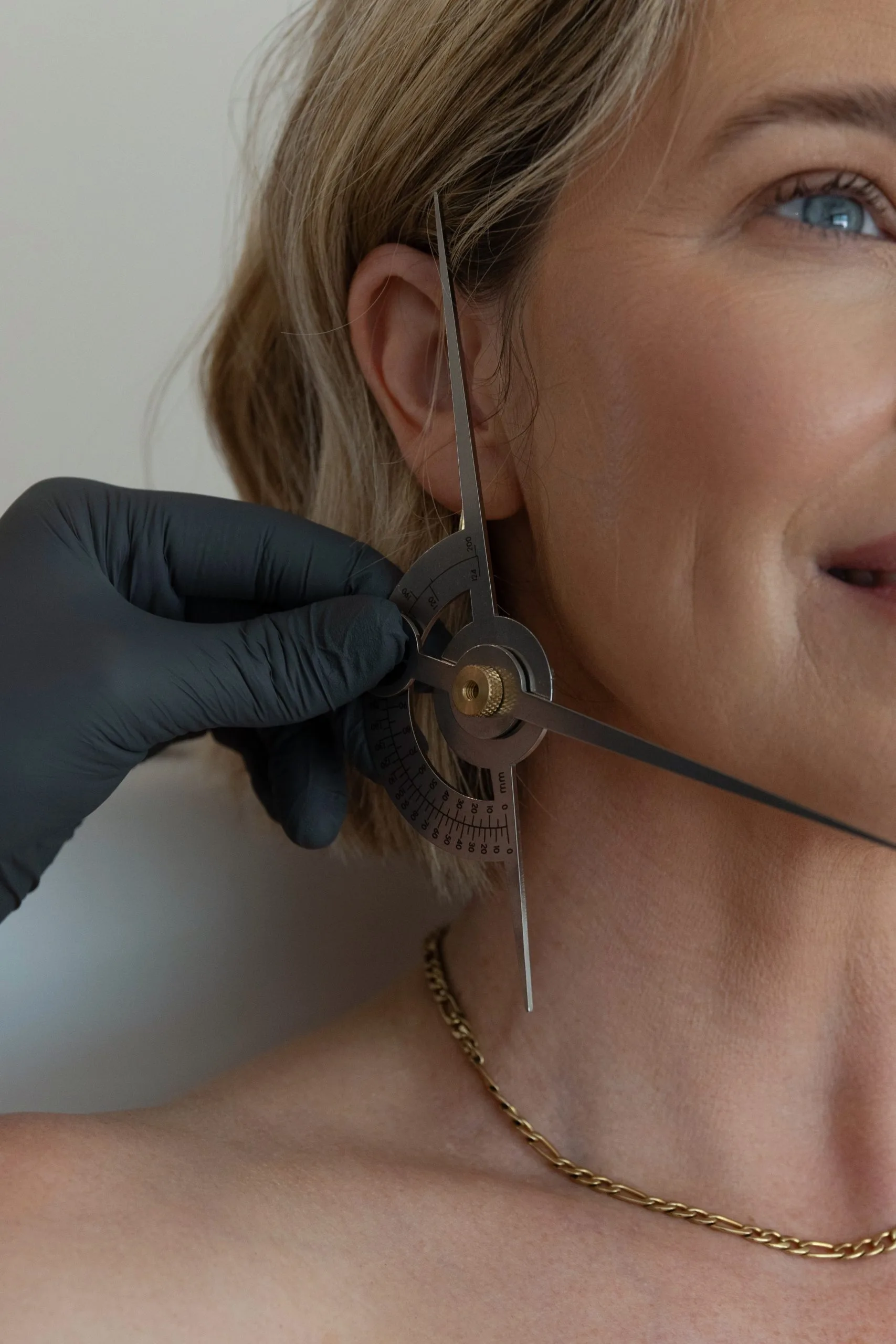 Close-up of calipers measuring patient's ear and jawline for facial assessment