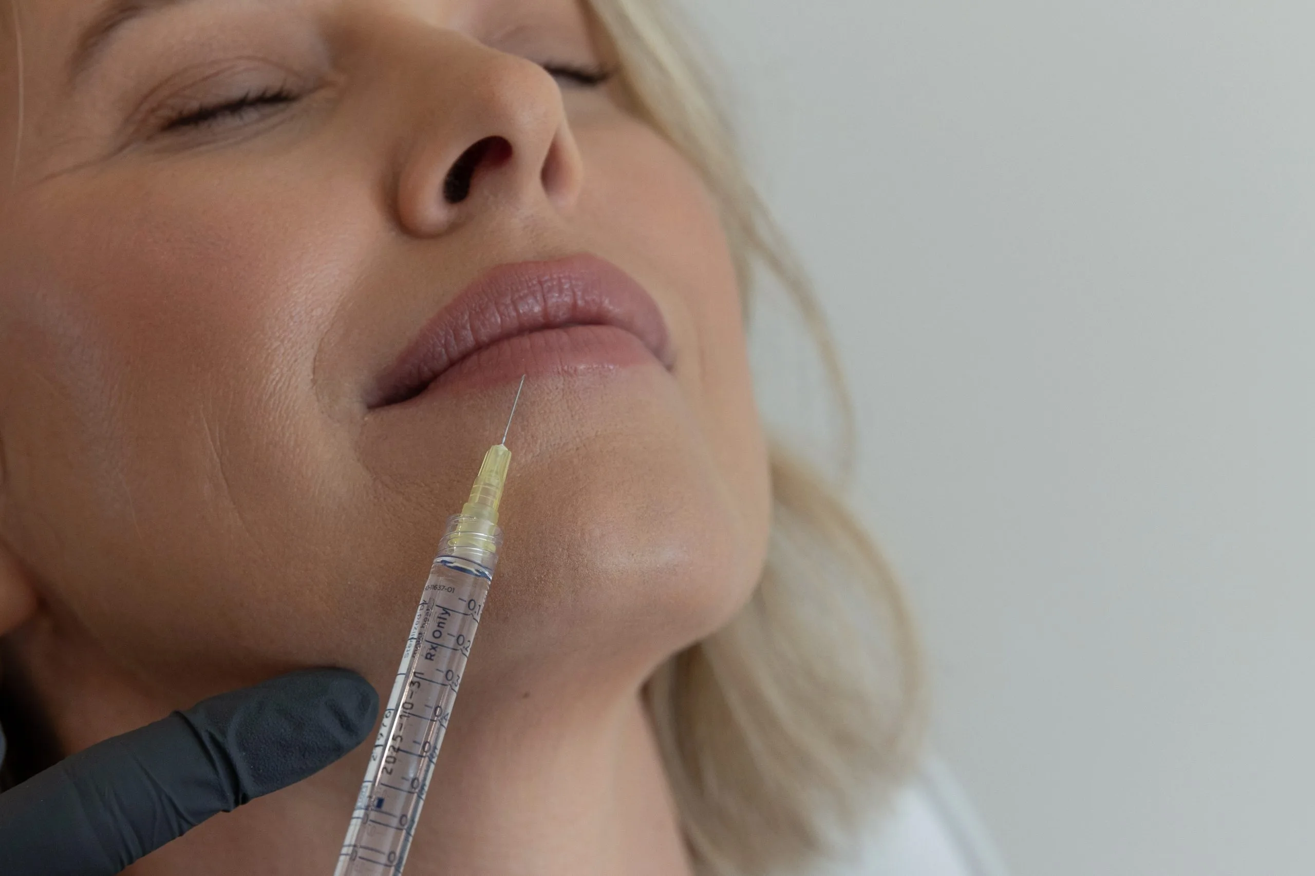 Practitioner injecting filler into patient's chin area