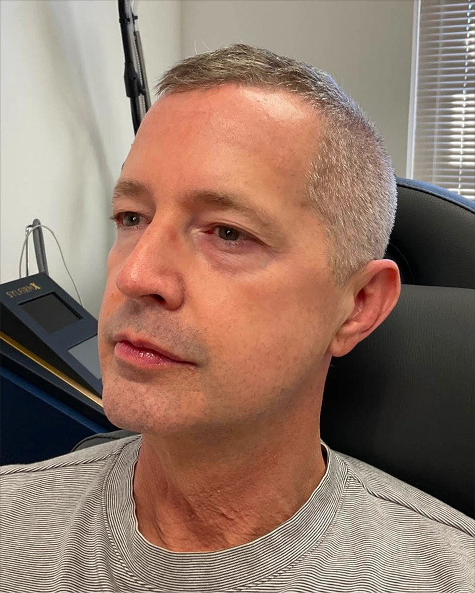 Man in striped shirt seated in treatment room during consultation