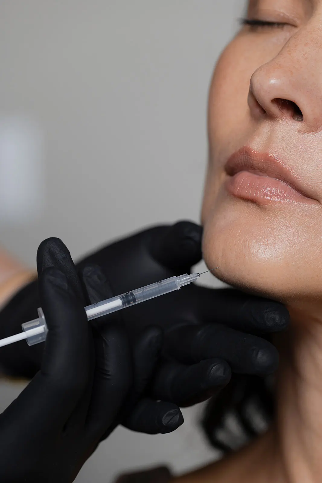 Practitioner in black gloves administering injectable treatment to patient's lips
