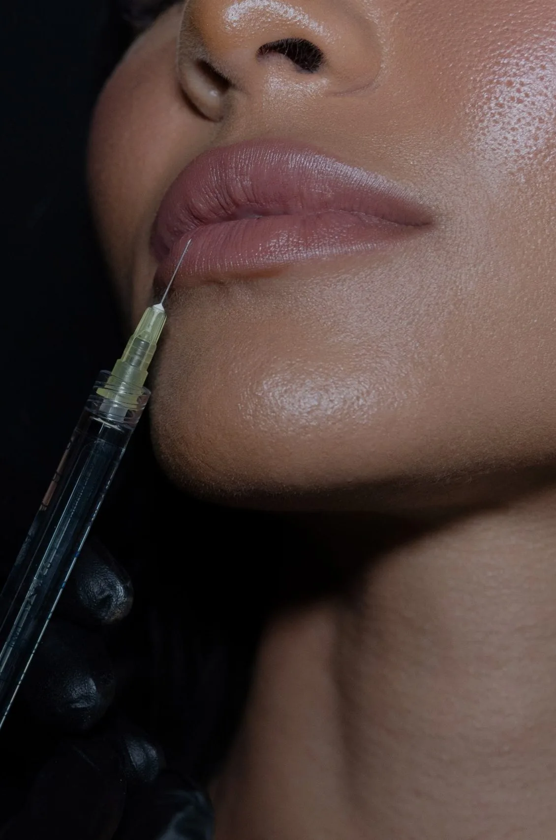 Injector pen applicator being applied to person's lips during treatment