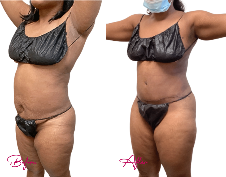 awake TUMMY - Case 5-2