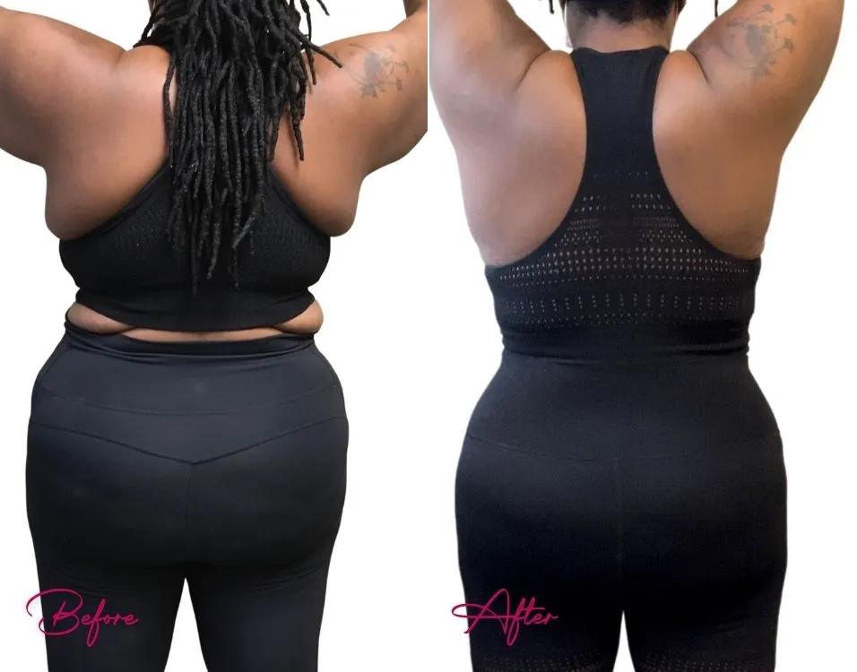 weight-loss-case-1
