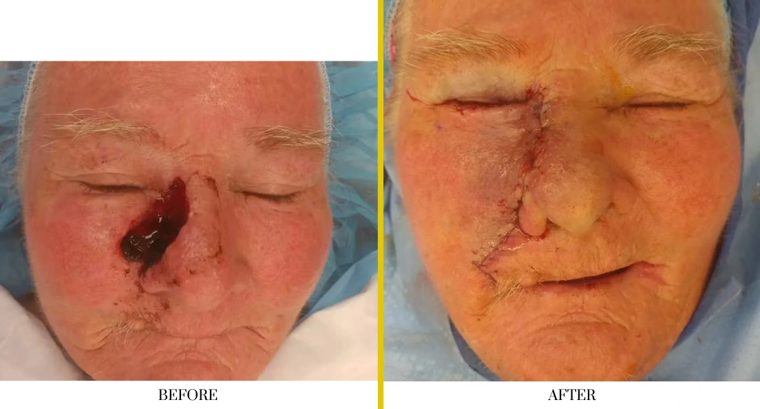 Facial (14)