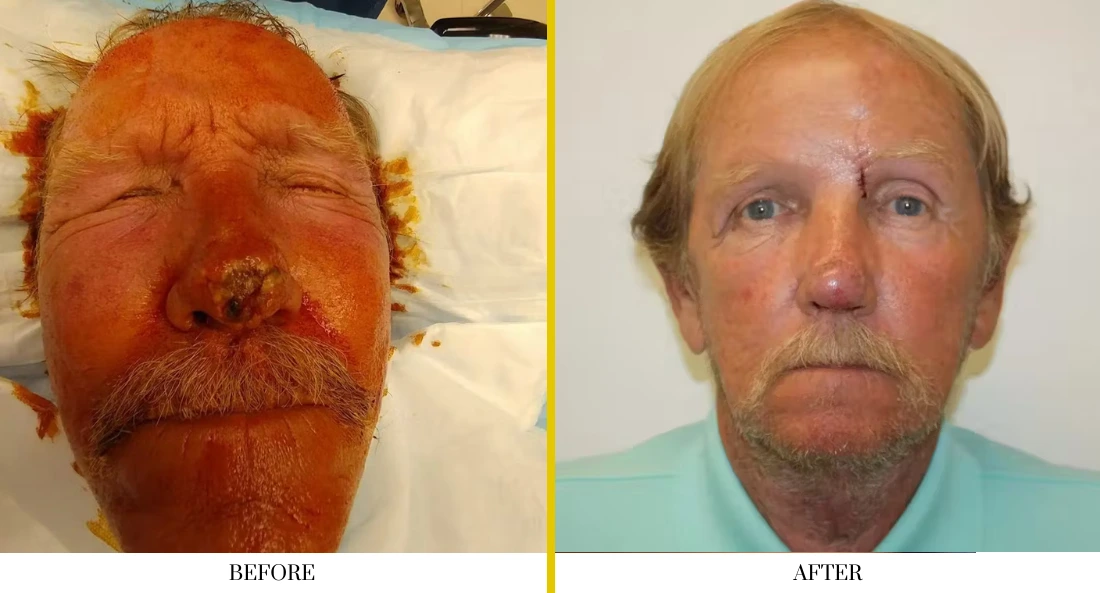 Facial (21)