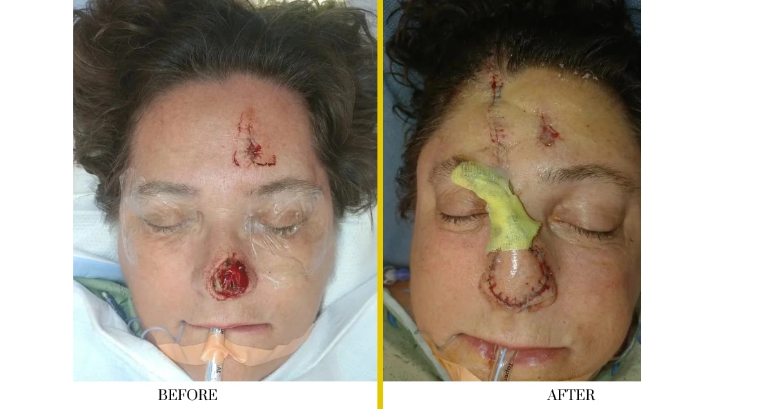Facial (26)