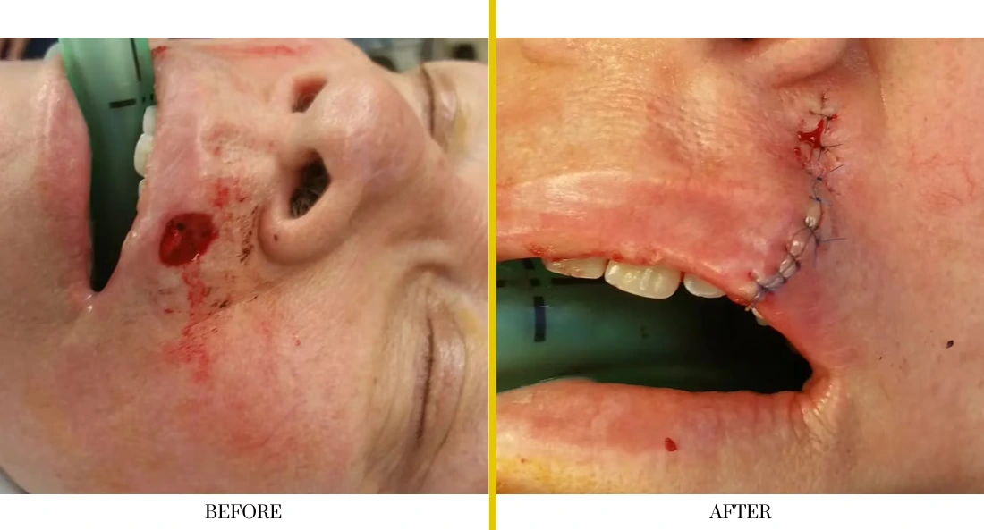 Facial (43)