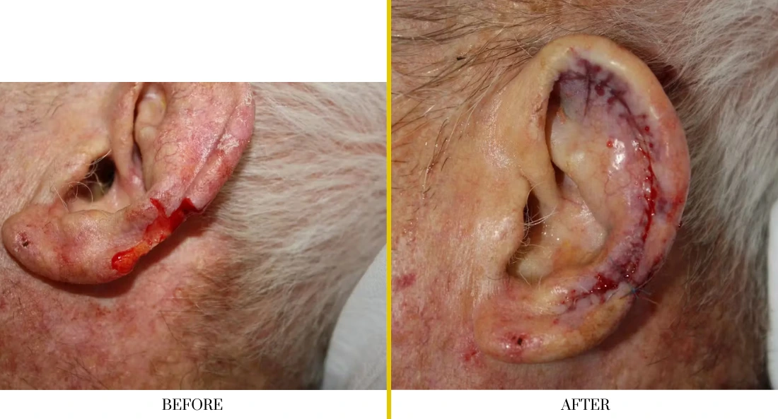 Before and after ear wound treatment demonstrating surgical repair and tissue healing