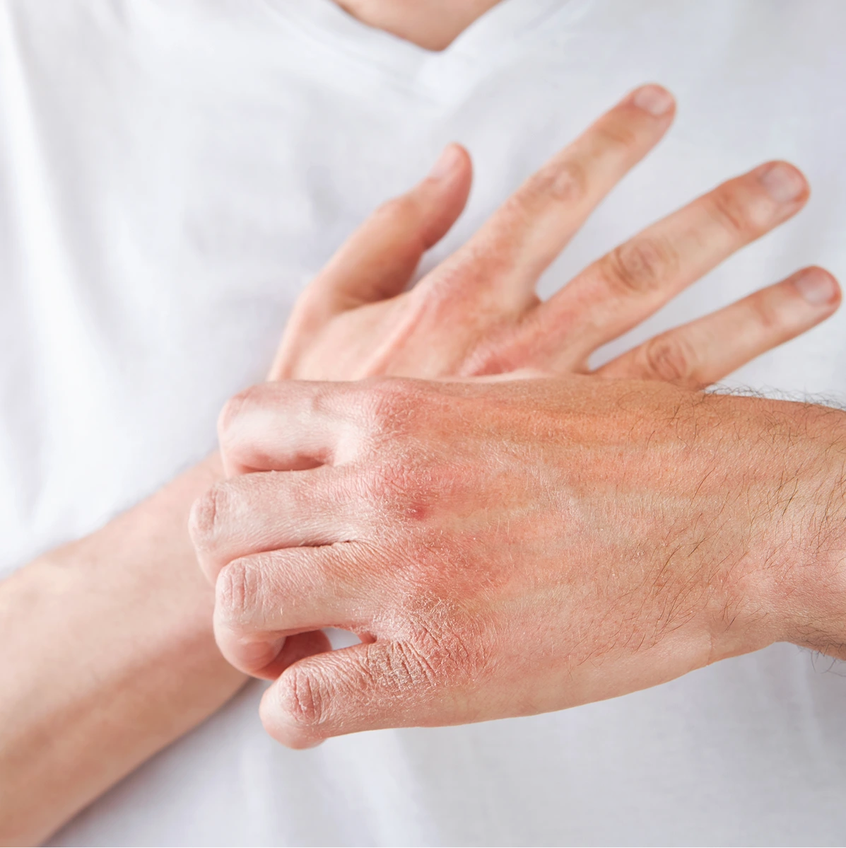 Diabetes Skin Conditions Treatment Phoenix, AZ Bg