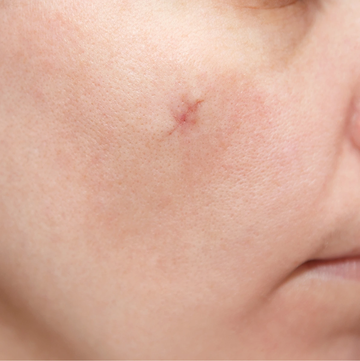 Wound Reconstruction Phoenix, Arizona Banner