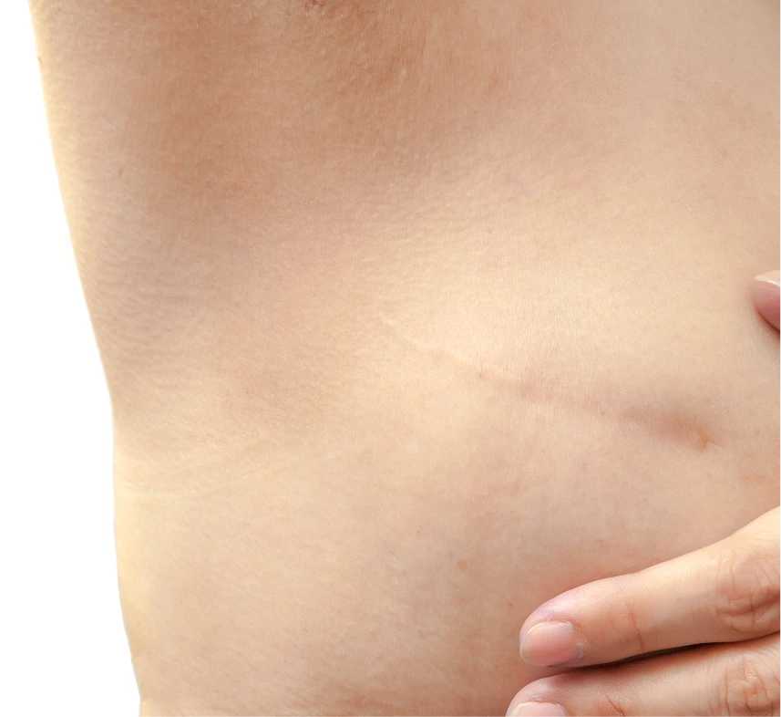 Wound Reconstruction Services in Phoenix, AZ Banner