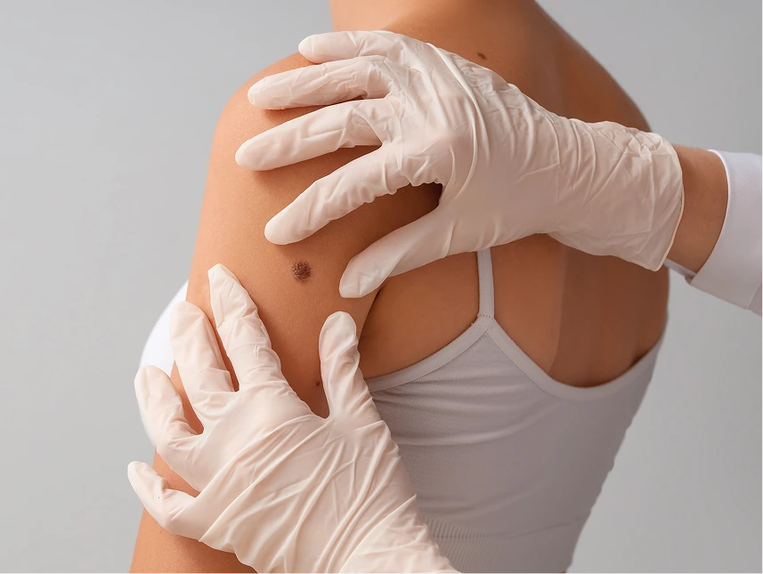 Skin Cancer Checks in Phoenix, AZ Banner