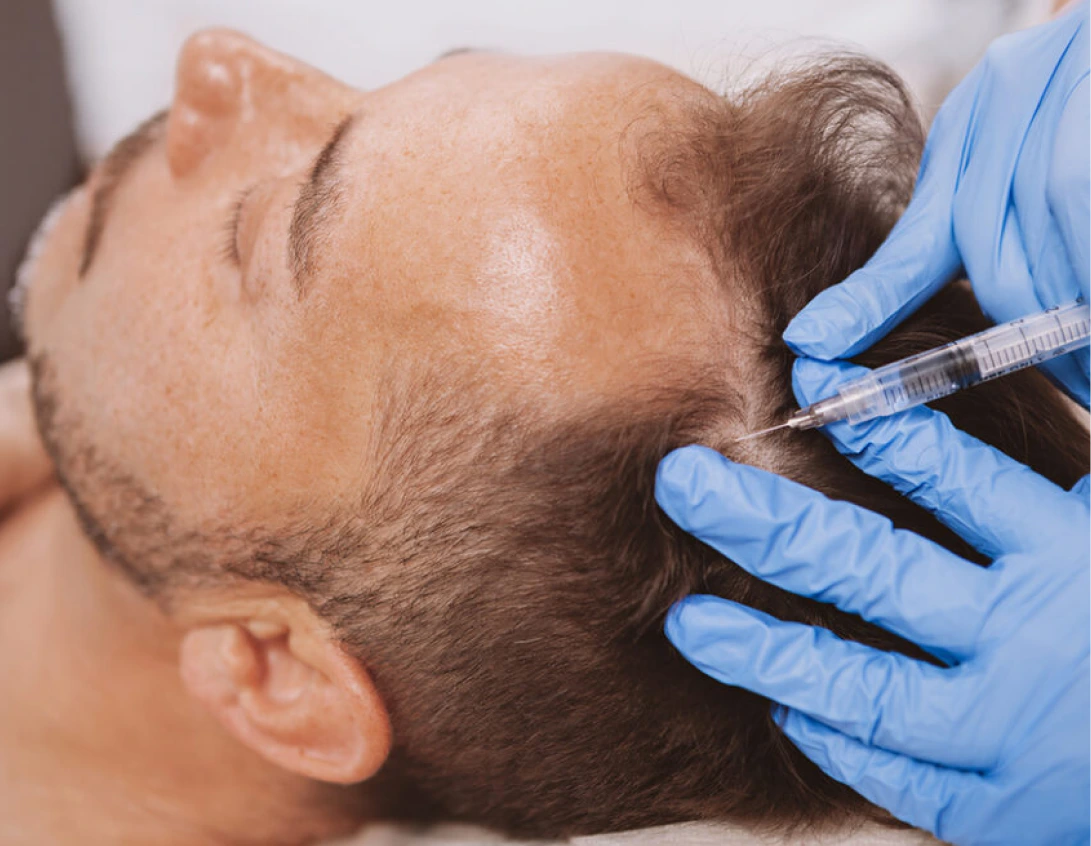 PRP Hair Restoration in Phoenix, AZ Banner