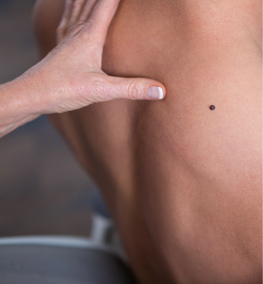 Skin Cancer Excision Surgery in Phoenix, Arizona Banner